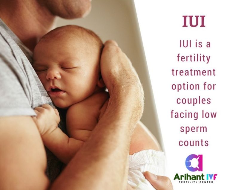 iui-treatment Sikar